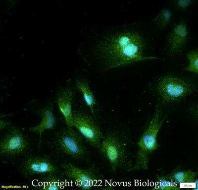 Immunocytochemistry/ Immunofluorescence: CD4 Antibody [NBP3-18057]