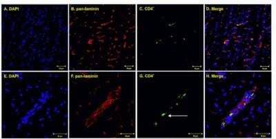 Immunohistochemistry: CD4 Antibody - BSA Free [NBP1-19371]