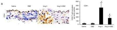 Immunohistochemistry: CD4 Antibody - BSA Free [NBP1-19371]