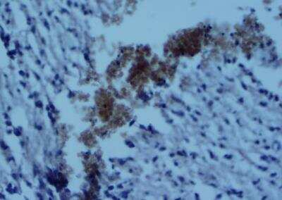 Immunohistochemistry-Paraffin: CD4 Antibody - BSA Free [NBP1-19371]