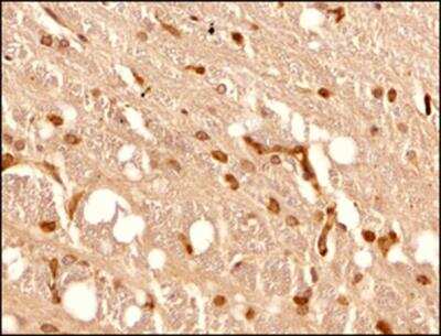 Immunohistochemistry-Paraffin: CD4 Antibody - BSA Free [NBP1-19371]