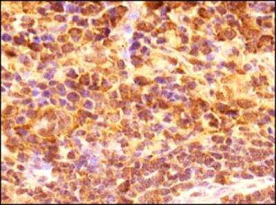 Immunohistochemistry-Paraffin: CD4 Antibody - BSA Free [NBP1-19371]