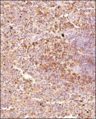 Immunohistochemistry-Paraffin: CD4 Antibody [NBP3-18057]