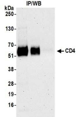 Immunoprecipitation: CD4 Antibody (BLR167J) [NBP3-14741]