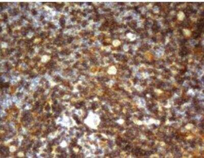 Immunohistochemistry-Paraffin: CD4 Antibody (OTI5D9) - Azide and BSA Free [NBP2-70357]