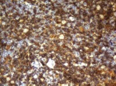 Immunohistochemistry: CD4 Antibody (OTI5D9) [NBP2-46149]