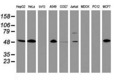 Western Blot: CD4 Antibody (OTI5D9) [NBP2-46149]