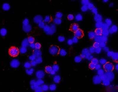 Immunocytochemistry/ Immunofluorescence: CD4 Antibody (W3/25) - Azide and BSA Free [NBP2-80647]