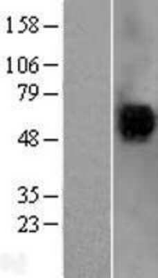 Western Blot: CD4 Overexpression Lysate [NBP2-04168]