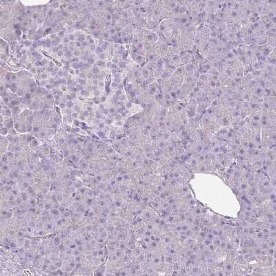 Immunohistochemistry: CD40 Ligand/TNFSF5 Antibody [NBP1-91770]