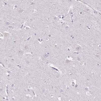 Immunohistochemistry-Paraffin: CD40 Ligand/TNFSF5 Antibody [NBP1-91770]