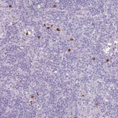 Immunohistochemistry-Paraffin: CD40 Ligand/TNFSF5 Antibody [NBP1-91770]