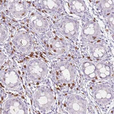 Immunohistochemistry-Paraffin: CD40 Ligand/TNFSF5 Antibody [NBP1-91770]