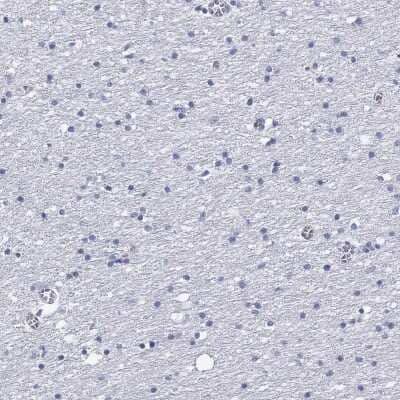 Immunohistochemistry-Paraffin: CD40 Ligand/TNFSF5 Antibody [NBP3-16982]