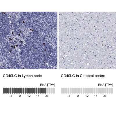 Immunohistochemistry-Paraffin: CD40 Ligand/TNFSF5 Antibody [NBP3-16982]