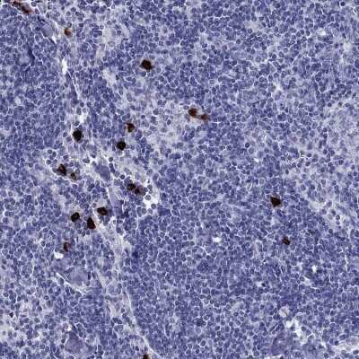 Immunohistochemistry-Paraffin: CD40 Ligand/TNFSF5 Antibody [NBP3-16982]