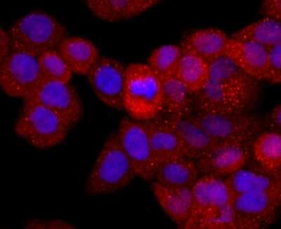 Immunocytochemistry/ Immunofluorescence: CD40 Ligand/TNFSF5 Antibody (JM11-34) [NBP2-66756]