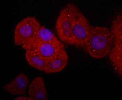 Immunocytochemistry/ Immunofluorescence: CD40 Ligand/TNFSF5 Antibody (JM11-34) [NBP2-66756]