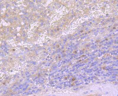 Immunohistochemistry-Paraffin: CD40 Ligand/TNFSF5 Antibody (JM11-34) [NBP2-66756]