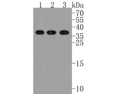 Western Blot: CD40 Ligand/TNFSF5 Antibody (JM11-34) [NBP2-66756]