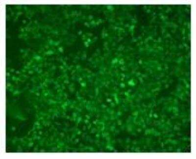 Immunocytochemistry/ Immunofluorescence: CD40 Ligand/TNFSF5 Antibody (LL2) [DDX0141P-100]