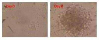 Immunocytochemistry: CD40 Ligand/TNFSF5 [DDX-S2]