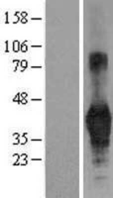 Western Blot: CD40/TNFRSF5 Overexpression Lysate [NBL1-08948]