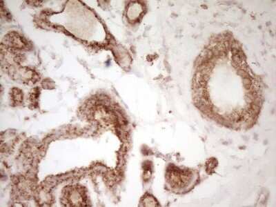 Immunohistochemistry: CD40/TNFRSF5 Antibody (OTI8B8) [NBP2-46150]