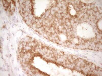 Immunohistochemistry: CD40/TNFRSF5 Antibody (OTI8B8) [NBP2-46150]