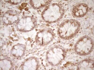 Immunohistochemistry: CD40/TNFRSF5 Antibody (OTI8B8) [NBP2-46150]