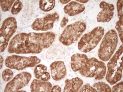 Immunohistochemistry: CD40/TNFRSF5 Antibody (OTI8B8) [NBP2-46150]