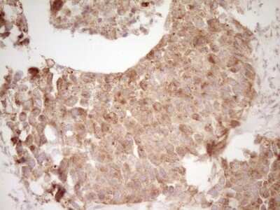Immunohistochemistry: CD40/TNFRSF5 Antibody (OTI8B8) [NBP2-46150]
