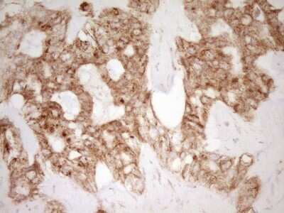 Immunohistochemistry: CD40/TNFRSF5 Antibody (OTI8B8) [NBP2-46150]