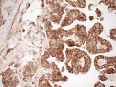 Immunohistochemistry: CD40/TNFRSF5 Antibody (OTI8B8) [NBP2-46150]