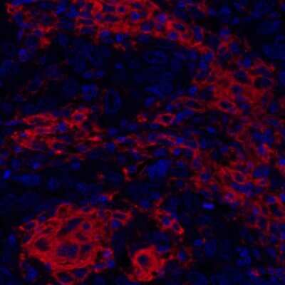 Immunocytochemistry/ Immunofluorescence: CD40/TNFRSF5 Antibody (BLR056F) [NBP2-76366]
