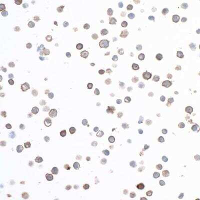 Immunocytochemistry/ Immunofluorescence: CD40/TNFRSF5 Antibody (BLR056F) [NBP2-76366]