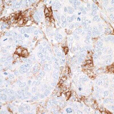 Immunohistochemistry-Paraffin: CD40/TNFRSF5 Antibody (BLR056F) [NBP2-76366]