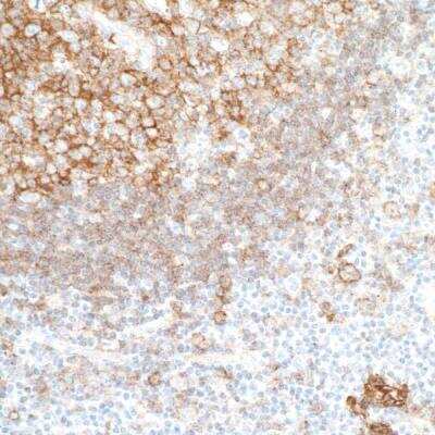 Immunohistochemistry-Paraffin: CD40/TNFRSF5 Antibody (BLR056F) [NBP2-76366]