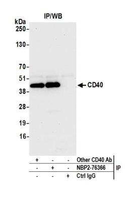 Immunoprecipitation: CD40/TNFRSF5 Antibody (BLR056F) [NBP2-76366]
