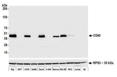 Western Blot: CD40/TNFRSF5 Antibody (BLR056F) [NBP2-76366]