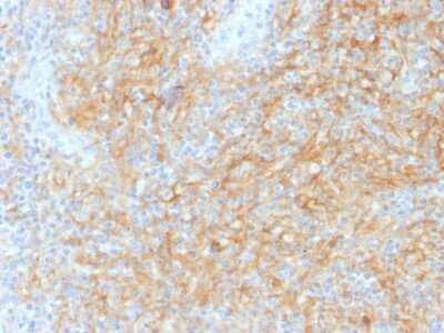 Immunohistochemistry-Paraffin: CD40/TNFRSF5 Antibody (C40/1605) - Azide and BSA Free [NBP2-54502]