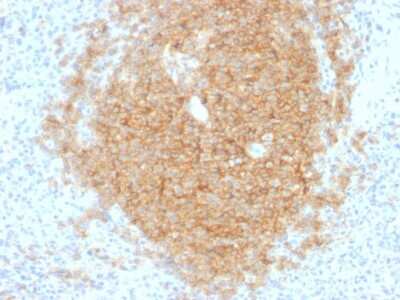 Immunohistochemistry-Paraffin: CD40/TNFRSF5 Antibody (C40/1605) [NBP2-53389]