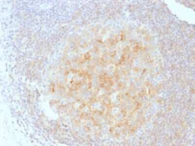 Immunohistochemistry-Paraffin: CD40/TNFRSF5 Antibody (C40/1605) [NBP2-53389]