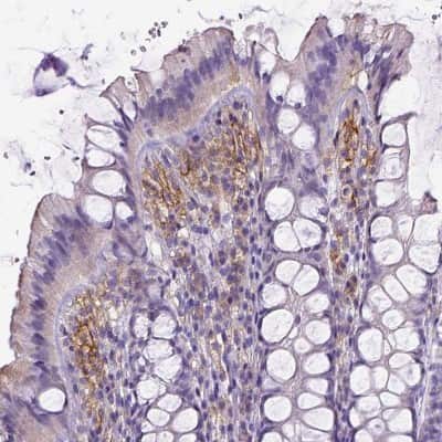 Immunohistochemistry-Paraffin: CD40/TNFRSF5 Antibody (CL1673) [NBP2-34488]