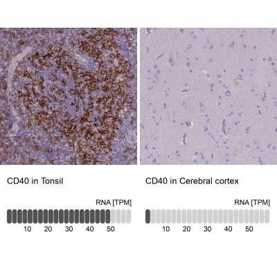 Immunohistochemistry-Paraffin: CD40/TNFRSF5 Antibody (CL1673) [NBP2-34488]