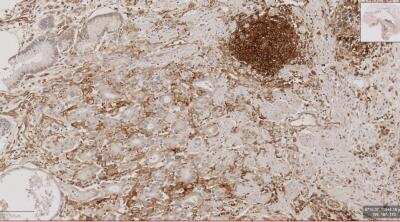 Immunohistochemistry-Paraffin: CD40/TNFRSF5 Antibody (CL1673) [NBP2-34488]