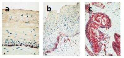 Immunohistochemistry-Paraffin: CD40/TNFRSF5 Antibody (G28-5) [DDX0130P-100]