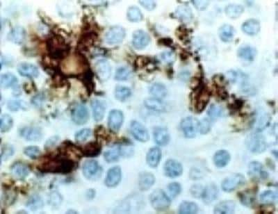 Immunohistochemistry-Paraffin: CD40/TNFRSF5 Antibody [NB100-56127]