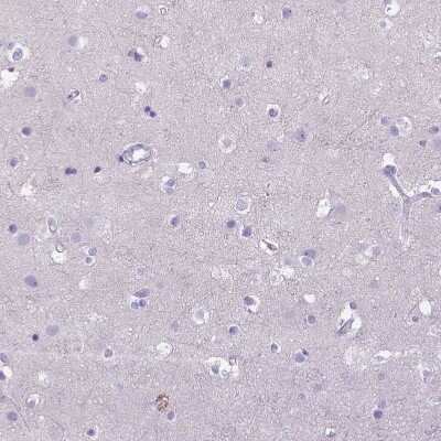 Immunohistochemistry-Paraffin: CD40/TNFRSF5 Antibody [NBP2-33956]