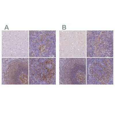 Immunohistochemistry-Paraffin: CD40/TNFRSF5 Antibody [NBP2-33956]